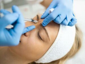 botox occhi